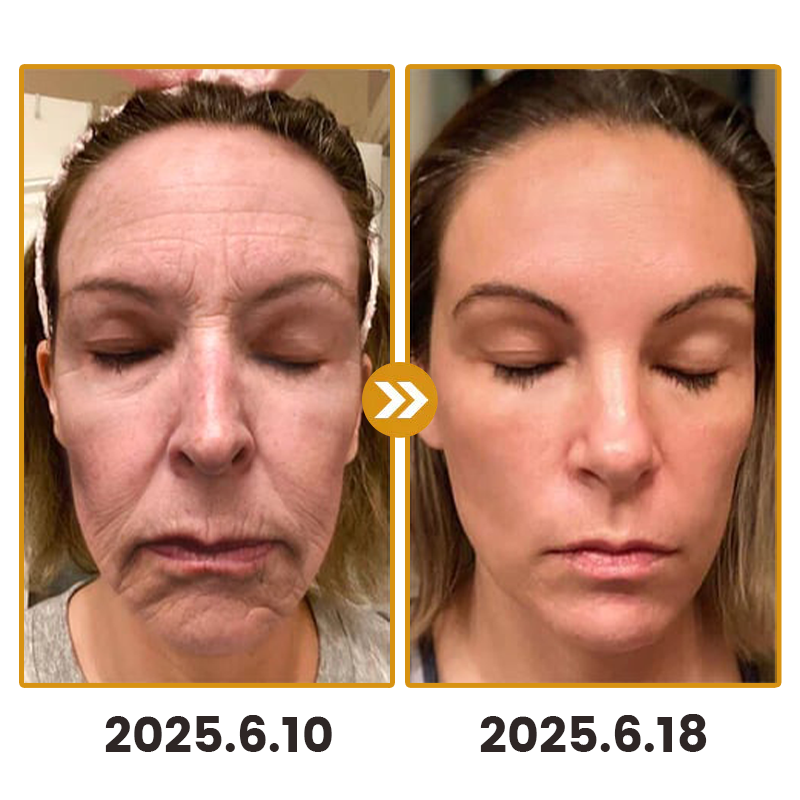 Lovilds™ Bee Toxin Skin Anti-Wrinkle Firming Cream