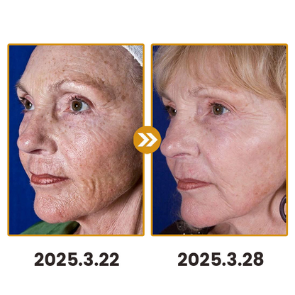 Lovilds™ Bee Toxin Skin Anti-Wrinkle Firming Cream