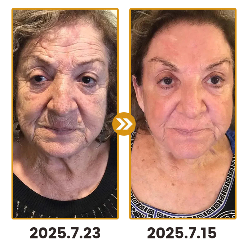 Lovilds™ Bee Toxin Skin Anti-Wrinkle Firming Cream