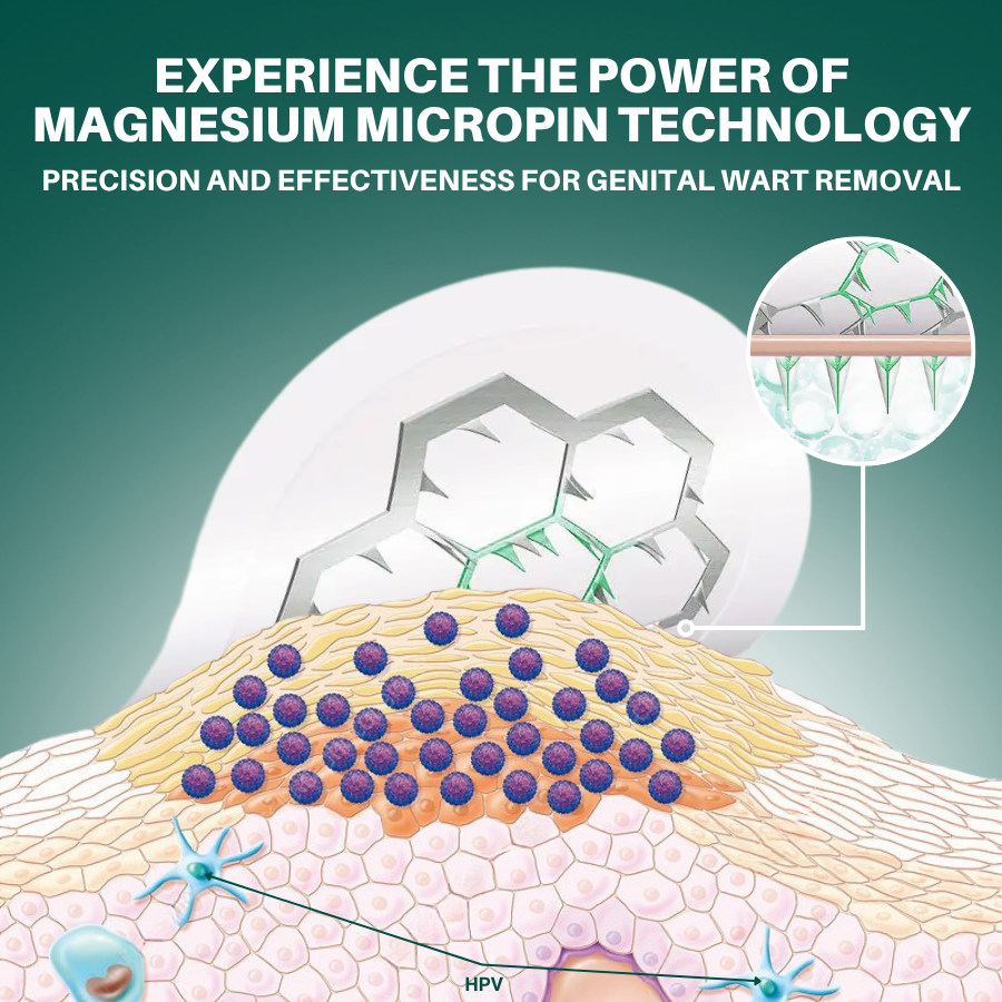 Alisanda™ Magnesium MicroPin HPV Genital Wart Removal Patch