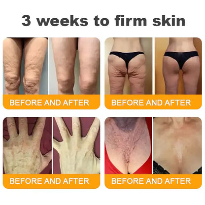 𝐋𝐎𝐕𝐈𝐋𝐃𝐒™ 𝐁𝐞𝐞 𝐕𝐞𝐧𝐨𝐦 𝐀𝐥𝐥-𝐢𝐧-𝐎𝐧𝐞 𝐂𝐫𝐞𝐚𝐦–🌸 Anti-aging,Hydrating, Skin Repair, Even Tone, Acne and Dark Spot Treatment, Wart and Mole Removal, Psoriasis Relief