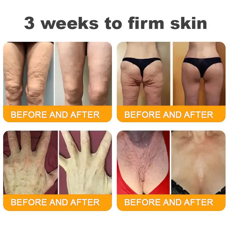 ✨FDA Approved:LOVILDS™ Bee Venom Skin Restoration Cream — 🔥Limited Time 70% OFF🔥  (8963 Reviews)