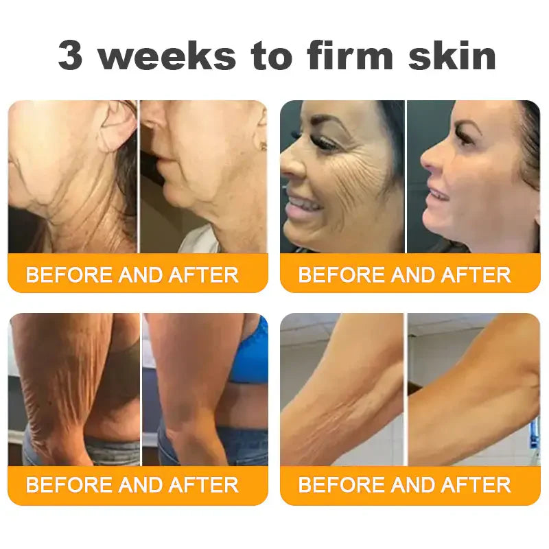 ✨FDA Approved:LOVILDS™ Bee Venom Skin Restoration Cream — 🔥Limited Time 70% OFF🔥  (8963 Reviews)