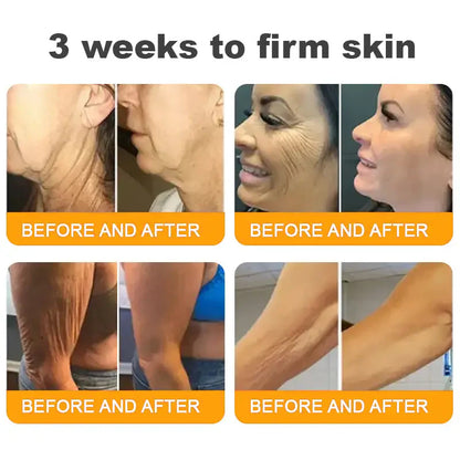 ✨FDA Approved:LOVILDS™ Bee Venom Skin Restoration Cream — 🔥Limited Time 70% OFF🔥  (8963 Reviews)