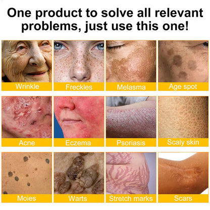 ✨FDA Approved:LOVILDS™ Bee Venom Skin Restoration Cream — 🔥Limited Time 70% OFF🔥  (8963 Reviews)